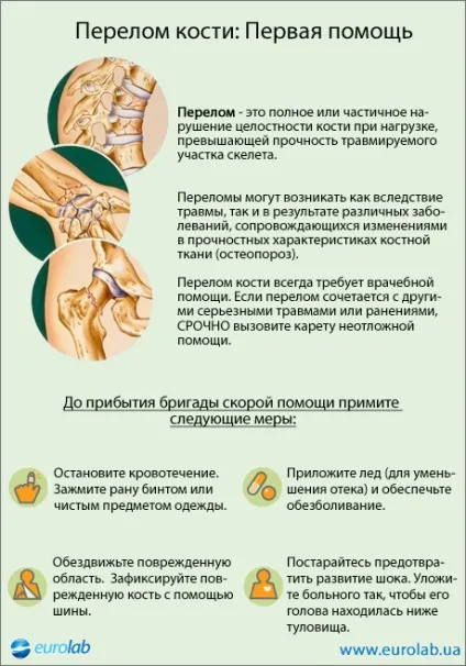 Порушення загоєння переломів кісток - травматологія - медична енциклопедія (загоєння) Порушення загоєння переломів кісток - травматологія - медична енциклопедія
