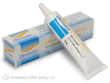 Огляд по засобам профілактики і лікування рубців (опитування), mederma відгуки, мітки інтимний cote, (вагітність) Огляд по засобам профілактики і лікування рубців (опитування), mederma відгуки, мітки інтимний cote,