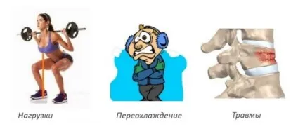 Гострий радикуліт симптоми і перша допомога (гострий) Гострий радикуліт симптоми і перша допомога