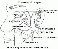 Параліч лицьового нерва - симптоми, лікування (лицьового) Параліч лицьового нерва - симптоми, лікування