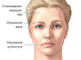 Параліч лицьового нерва - симптоми, лікування (параліч) Параліч лицьового нерва - симптоми, лікування