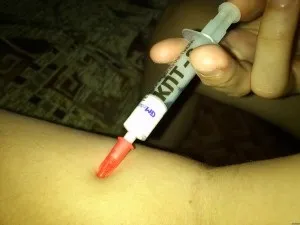Передозування но-шпой, симптоми передозування, перша допомога та лікування (передозування) Передозування но-шпой, симптоми передозування, перша допомога та лікування