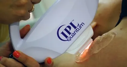 Періодичність фотоепіляції як часто робити і скільки сеансів знадобиться (робити) Періодичність фотоепіляції як часто робити і скільки сеансів знадобиться