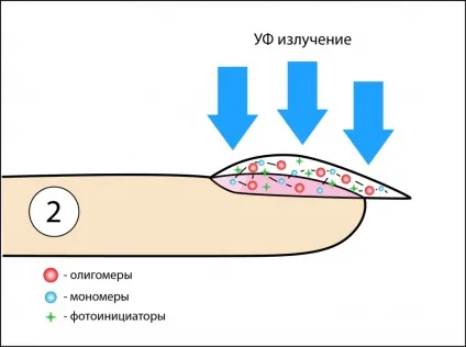 Чому при нарощуванні нігтів гель пече (нарощуванні) Чому при нарощуванні нігтів гель пече