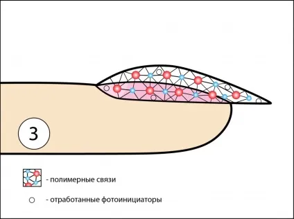 Чому при нарощуванні нігтів гель пече (чому при нарощуванні нігтів гель пече?) Чому при нарощуванні нігтів гель пече