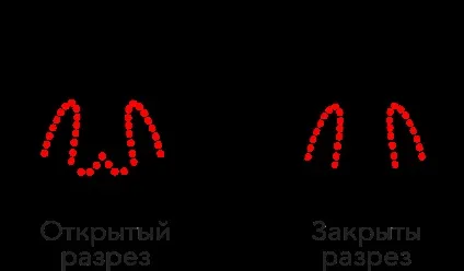 пластика носа