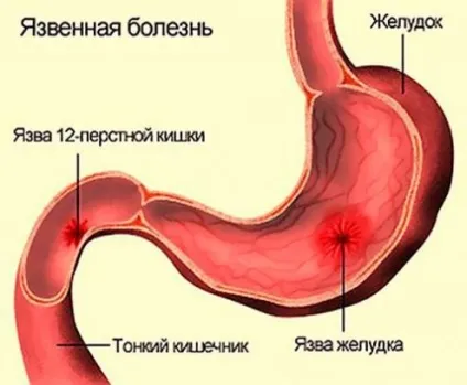 Пилорический відділ шлунка де знаходиться, будова, гістологія (пилорический) Пилорический відділ шлунка де знаходиться, будова, гістологія