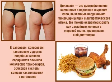 Чи допомагає масаж від целюліту, протипоказання, побічні ефекти, фото до і після (побічні) Чи допомагає масаж від целюліту, протипоказання, побічні ефекти, фото до і після