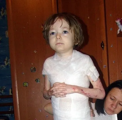 Допоможіть ліз кунігель