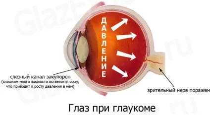 Прилад галазомір інструкція, протипоказання, відгуки