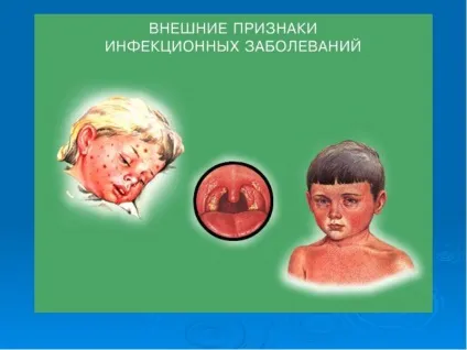 Презентація по темі урок по ОБЖ інфекційні захворювання (ОБЖ) Презентація по темі урок по ОБЖ інфекційні захворювання