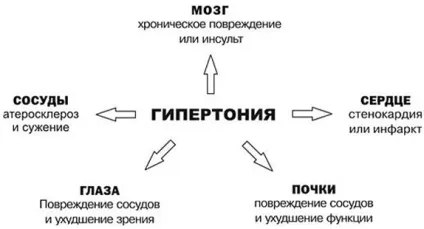 Причини високого тиску у чоловіків і жінок, профілактика гіпертонічної хвороби (артеріальної (чоловіків) Причини високого тиску у чоловіків і жінок, профілактика гіпертонічної хвороби (артеріальної