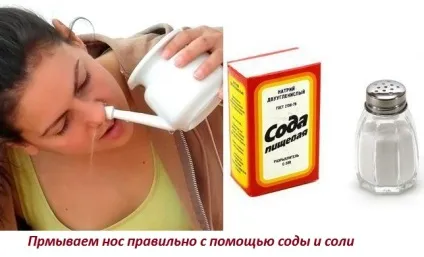 Промивання носа содою і сіллю - прості і швидкі рецепти лікування від zdravoline (прості) Промивання носа содою і сіллю - прості і швидкі рецепти лікування від zdravoline
