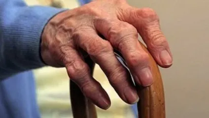 Ревматоїдний артрит лікування народними засобами в домашніх умовах і харчуванням (лікування) Ревматоїдний артрит лікування народними засобами в домашніх умовах і харчуванням