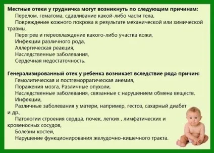 Чому у новонароджених опухлі повіки (очей новонародженого супроводжується) Чому у новонароджених опухлі повіки
