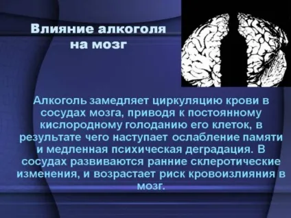 Чому трясуться руки після п'янки і як позбутися від Тремер (руки) Чому трясуться руки після п'янки і як позбутися від Тремер