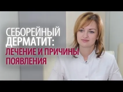 Себорейний дерматит на обличчі симптоми і лікування, мазі, креми