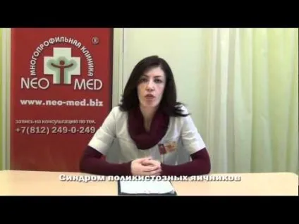 Синдром полікістозних яєчників (СПКЯ) симптоми, лікування і що це таке (СПКЯ) Синдром полікістозних яєчників (СПКЯ) симптоми, лікування і що це таке