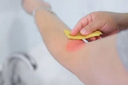 Користь бананової шкірки