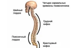 Сутулість у дитини причини виникнення