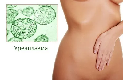 Свічки від уреаплазми для жінок лікування і опис препарату