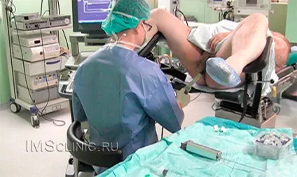 Трансректальная біопсія простати під місцевою анестезією (трансректальной біопсії простати) Трансректальная біопсія простати під місцевою анестезією