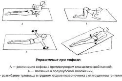 Вправи при кіфозі