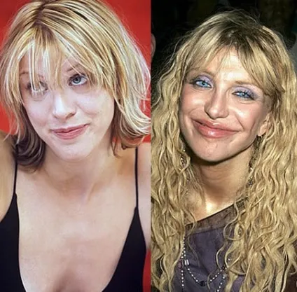 Збільшення губ способи і вартість збільшення обсягу відео відгуки після процедури (способи) Збільшення губ способи і вартість збільшення обсягу відео відгуки після процедури