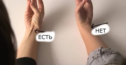Ваше сухожилля видно на зап'ясті ось що це означає! (Здоров'я) Ваше сухожилля видно на зап'ясті ось що це означає!