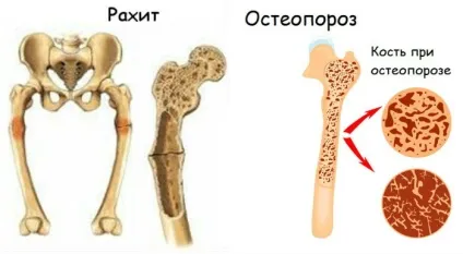 Вальгусна деформація колінних суглобів лікування, масаж, фото (вальгусна) Вальгусна деформація колінних суглобів лікування, масаж, фото