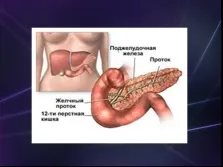 Презентація - цукровий діабет (цукровий) Презентація - цукровий діабет