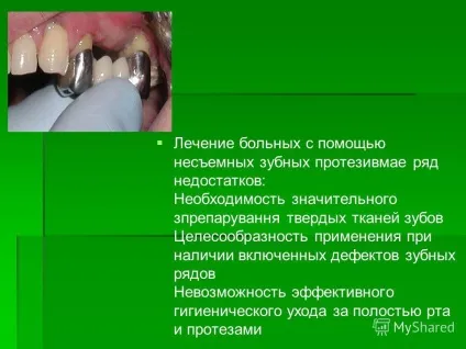Презентація на тему актуальність естетичними і низькоефективними конструкціями серед знімних (тему) Презентація на тему актуальність естетичними і низькоефективними конструкціями серед знімних