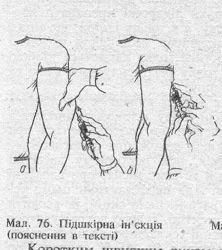 Внутрішкірна діагностична проба на індивідуальну чутливість до антибіотиків