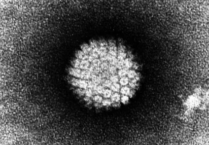 Вірус папіломи людини лікування, причини, діагностика hpv, science debate (людини) Вірус папіломи людини лікування, причини, діагностика hpv, science debate