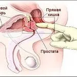 Чи шкідливий частий масаж простати
