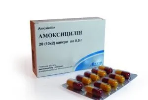 Запалення слухової труби причини, симптоми, лікування (труби) Запалення слухової труби причини, симптоми, лікування