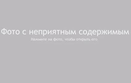 Все, що потрібно знати власнику, якщо у його собаки стафілокок симптоми і лікування (собаки) Все, що потрібно знати власнику, якщо у його собаки стафілокок симптоми і лікування