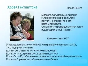 Хорея лікування, хорея вагітних (хорея) Хорея лікування, хорея вагітних