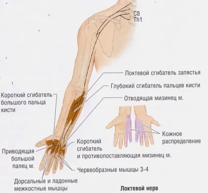 Защемлення променевого нерва в руці, лікування кисті в домашніх умовах (руці) Защемлення променевого нерва в руці, лікування кисті в домашніх умовах
