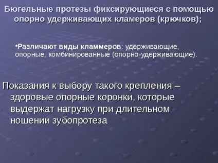 Протезування бюгельнимі протезами