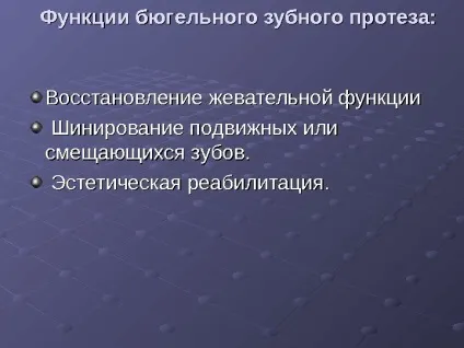 Протезування бюгельнимі протезами