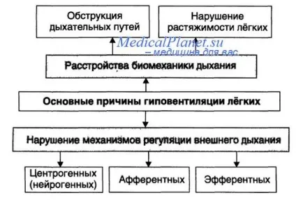 Альвеолярна гіповентиляція (гіповентиляція) альвеолярна гіповентиляція