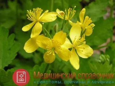 Аутоімунний тиреоїдит - симптоми, причини, лікування, наслідки