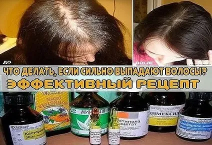 Бабусині секрети як виростити довгі і густі волосся всього за місяць - в мережі - себе просвіти! (Вимішує) Бабусині секрети як виростити довгі і густі волосся всього за місяць - в мережі - себе просвіти!