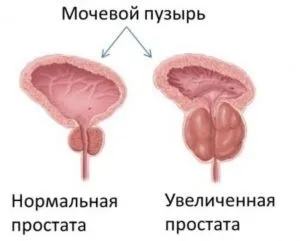 Біль справа внизу живота у чоловіків 5 причин викликати швидку допомогу! (Внизу) Біль справа внизу живота у чоловіків 5 причин викликати швидку допомогу!