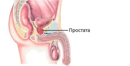 Болі в попереку при простатиті у чоловіків, симптоми, лікування (лікування) Болі в попереку при простатиті у чоловіків, симптоми, лікування