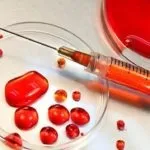 Що таке метастази при раку, симптоми і лікування метастазів (раку) Що таке метастази при раку, симптоми і лікування метастазів