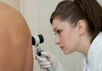 Дерматофіброма - причини, симптоми, діагностика та лікування (симптоми) Дерматофіброма - причини, симптоми, діагностика та лікування