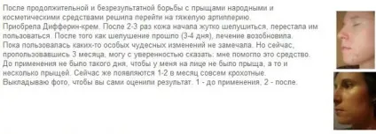 Ефективний засіб від прищів - яке саме, на обличчі, в аптеці, відгуки, від плям, у підлітків