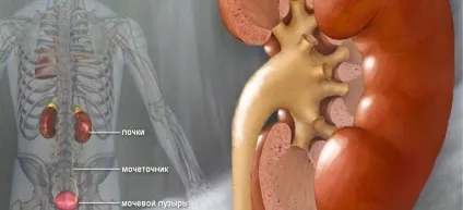 Ефективні методи лікування сечокам'яної хвороби без операції (лікування) Ефективні методи лікування сечокам'яної хвороби без операції
